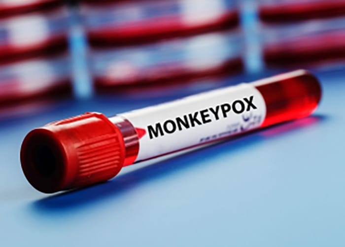 India Confirms Mpox Case